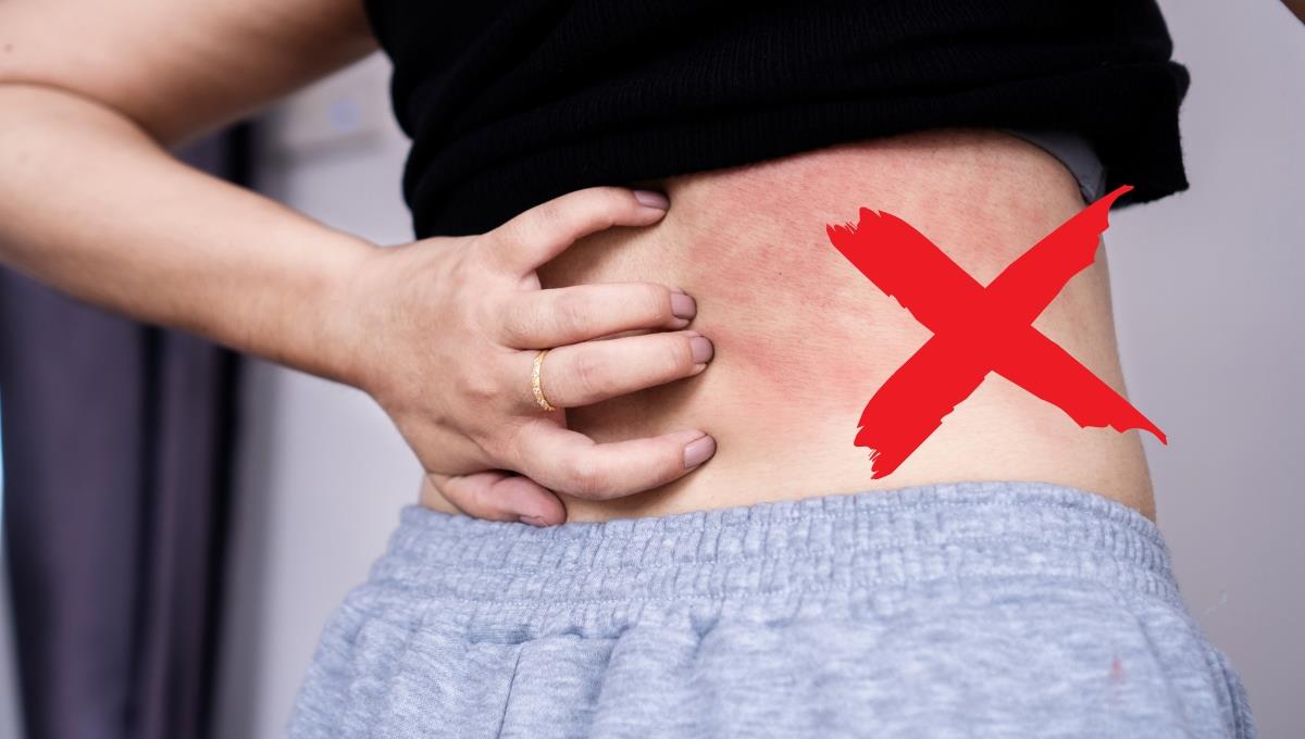 El truco sencillo para solucionar el sarpullido en la piel